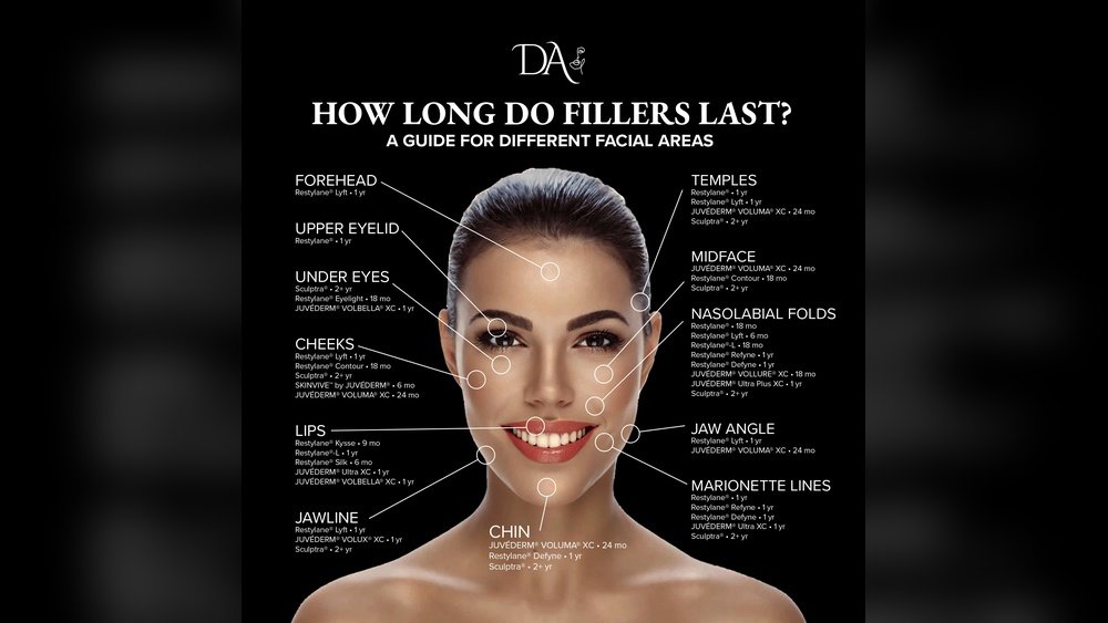 How Long Does Cheek Filler Last