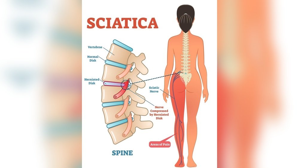 Why Does My Butt Cheek Hurt